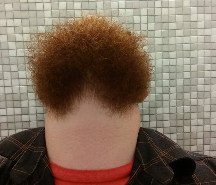 15 Obrázkov: Chlapík so zaklonenou hlavou potrebuje novú tvár