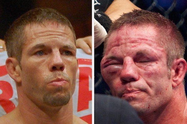 14 brutálnych pred a po fotografií zápasníkov UFC