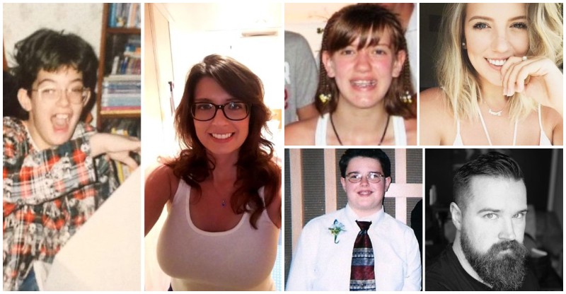 30+ Obrázkov: Škaredé káčatká, z ktorých sa vykľuli poriadne labute – takže ešte máš možno malú nádej