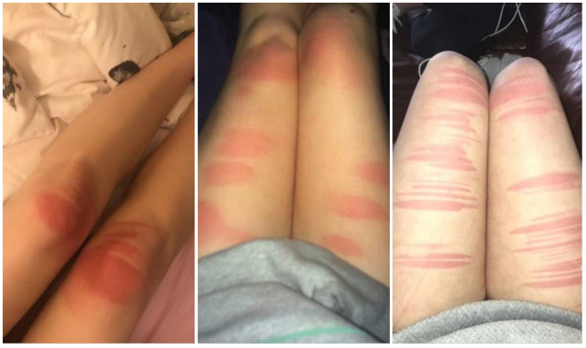 15+ Obrázkov: Roztrhané rifle vs slnko