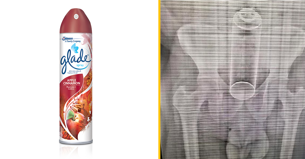 Mužovi sa po sexuálnej hre zasekol v zadku osviežovač vzduchu – museli ho operovať