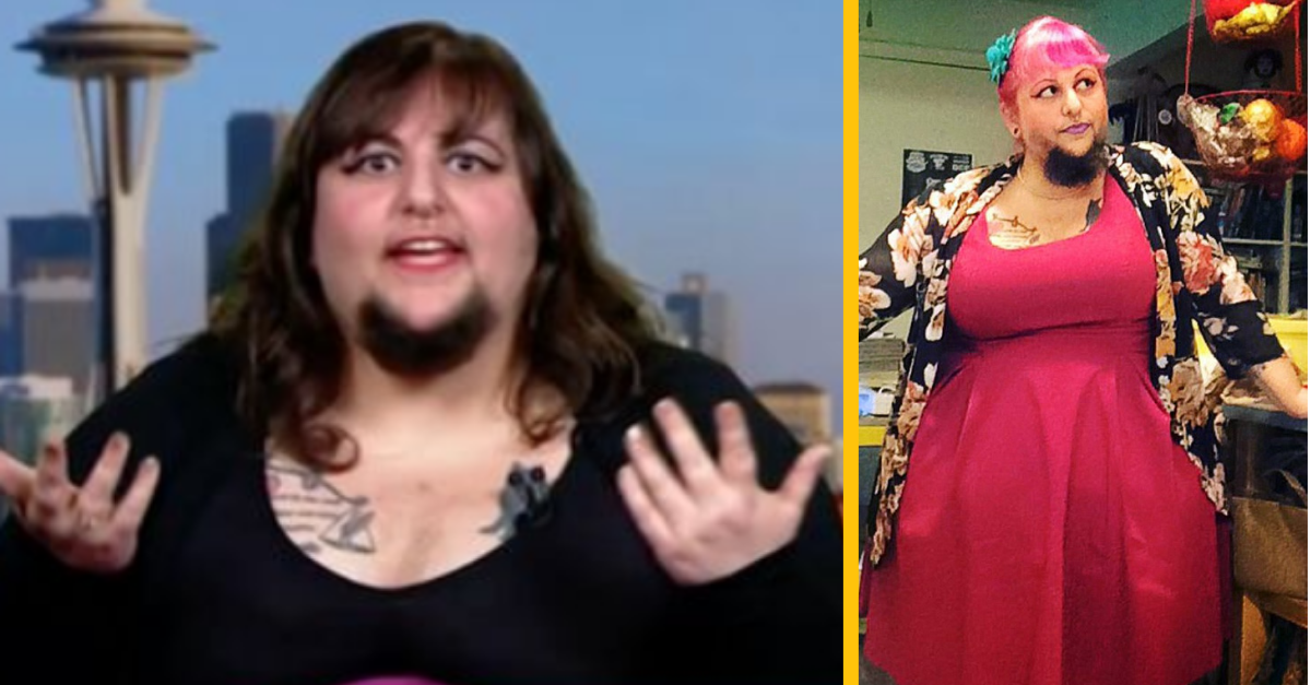 Bradatá žena si myslela, že nikdy nenájde lásku – teraz sa konečne vydala