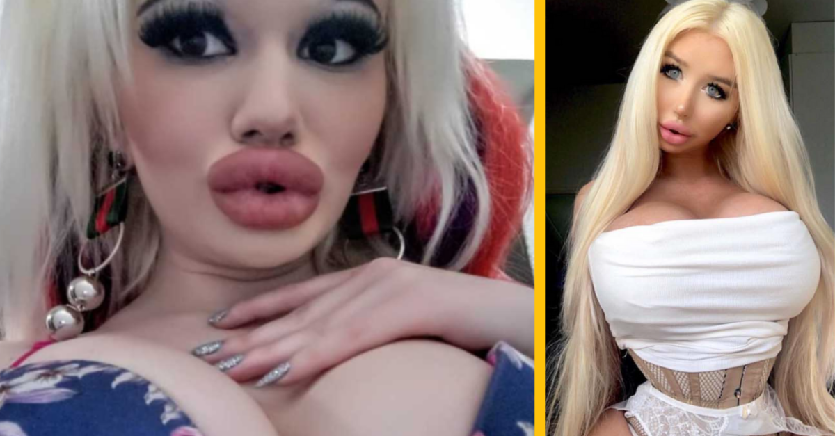 Žena podstúpila za rok 15 operácií, aby vyzerala ako bábika Barbie