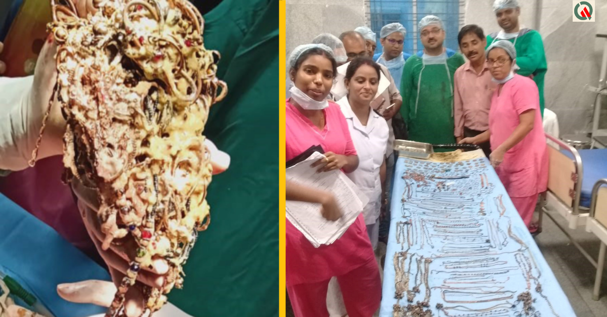 Doktori vytiahli žene zo žalúdka 1.6 kg chuchvalec šperkov, peňazí a hodiniek