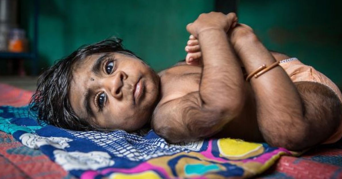 Novorodencom poplietli lieky a dostali omylom prípravok proti vypadávaniu vlasov