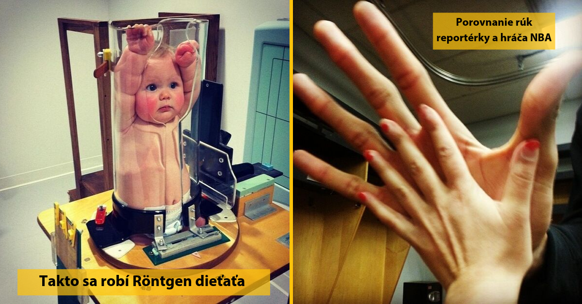 20 fotografií, ktoré dokazujú, že ľudské telo je skutočnou záhadou