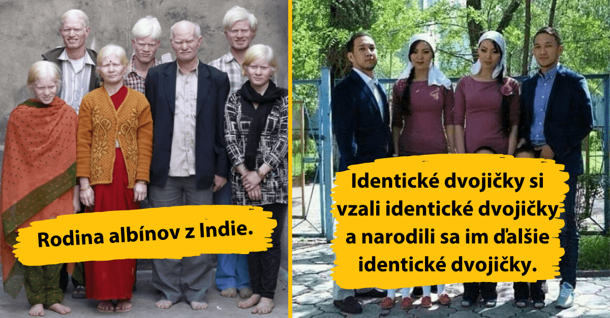 15 genetických zázrakov a mutácií na fotografiách z celého sveta. Čo všetko dokáže ľudské telo je úžasné !
