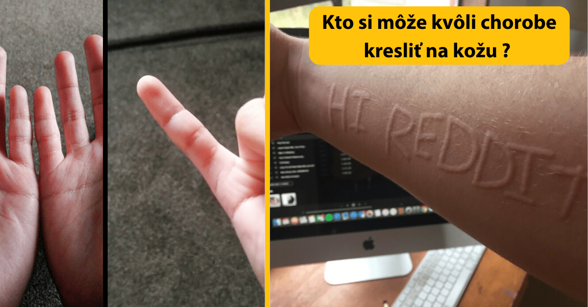 Kompilačka (nad)ľudí, ktorí sa v dave jednoducho nestratia