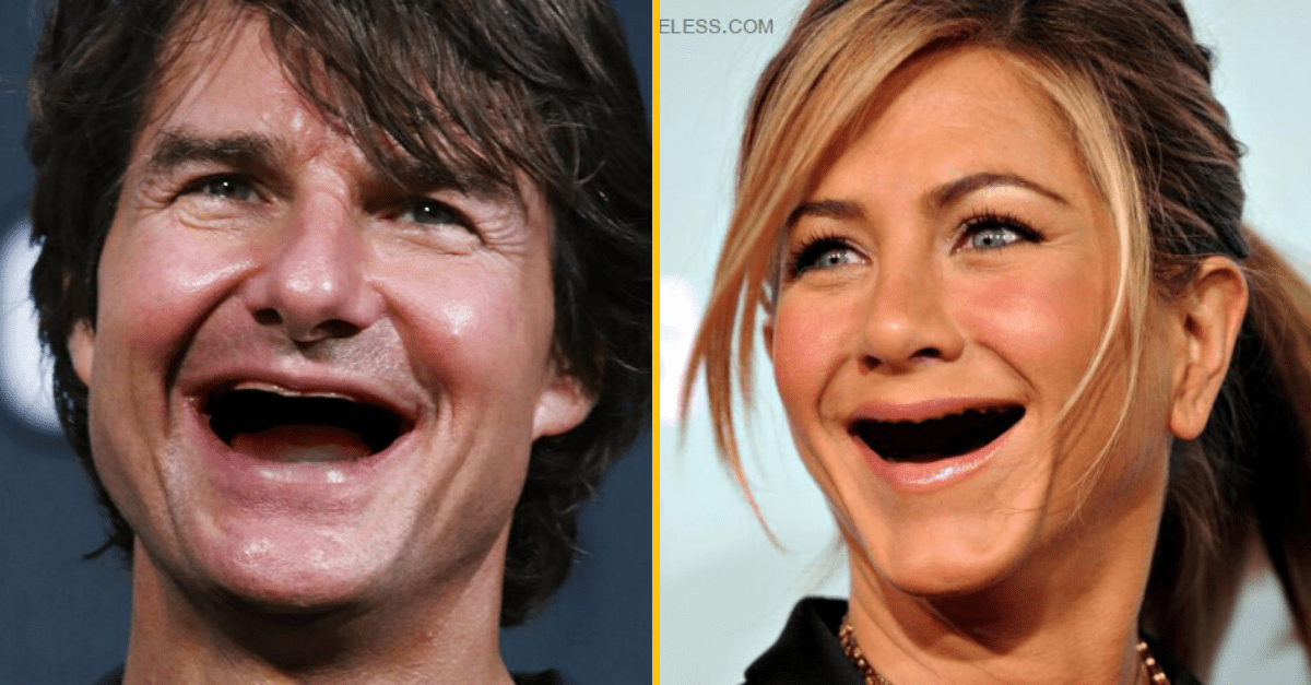 20 celebrít bez zubov – presne toto si dnes potreboval vidieť