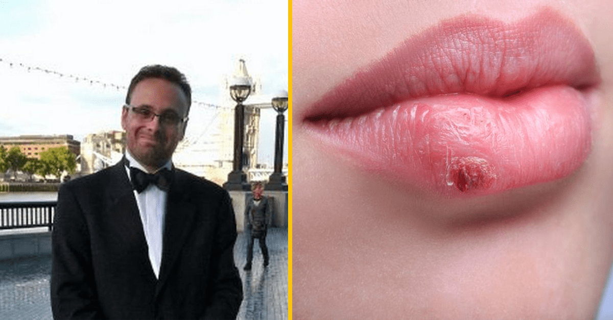 Muž žaluje svoju partnerku, pretože od nej dostal herpes. Zaplatiť mu za to má 145 000€