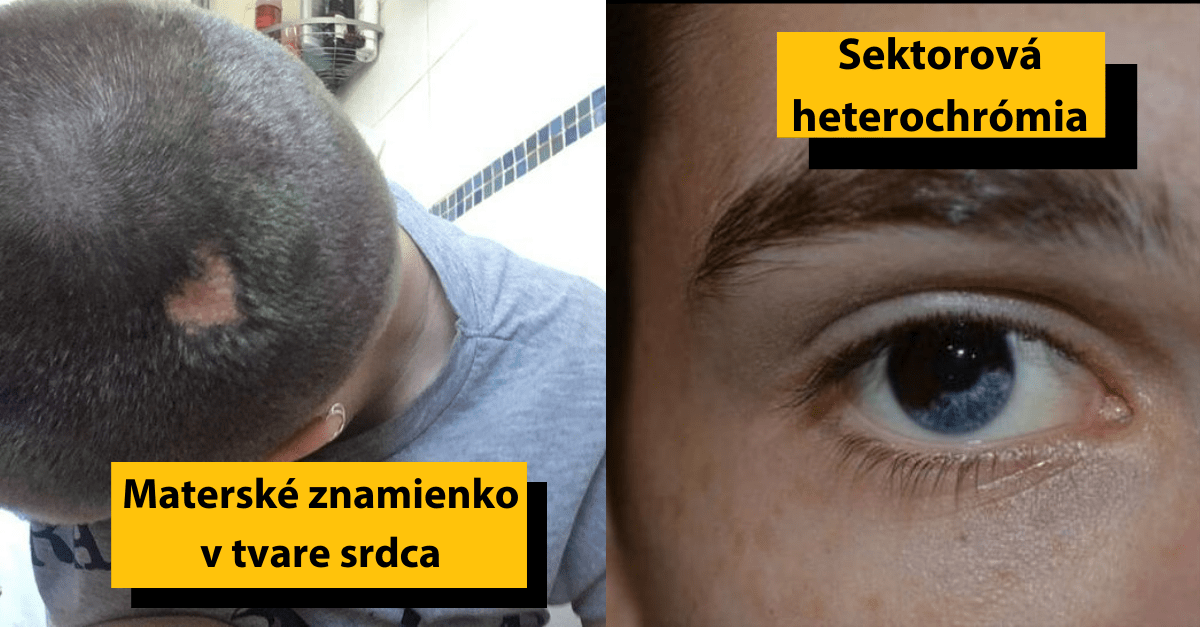 17 ľudí, ktorých niektoré časti tela vyzerajú ako od mimozemšťanov