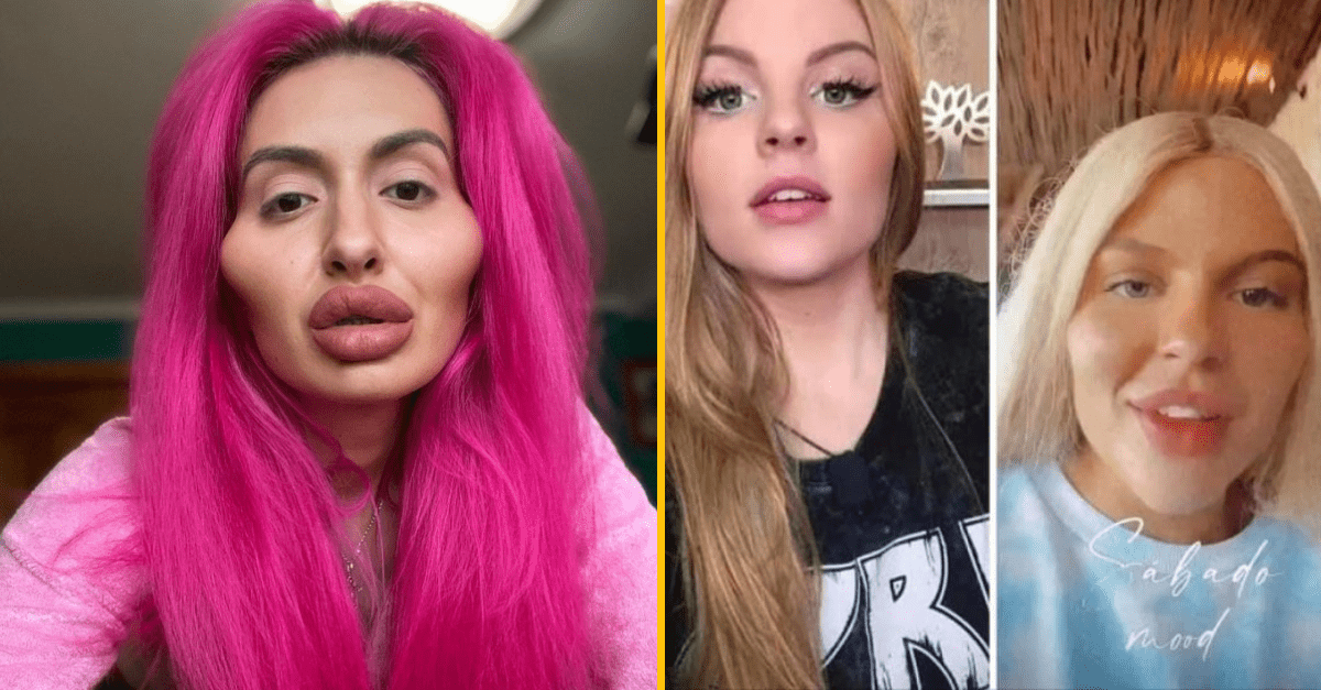 20+ otrasných plastických operácii, ktorými si ľudia zničili telo