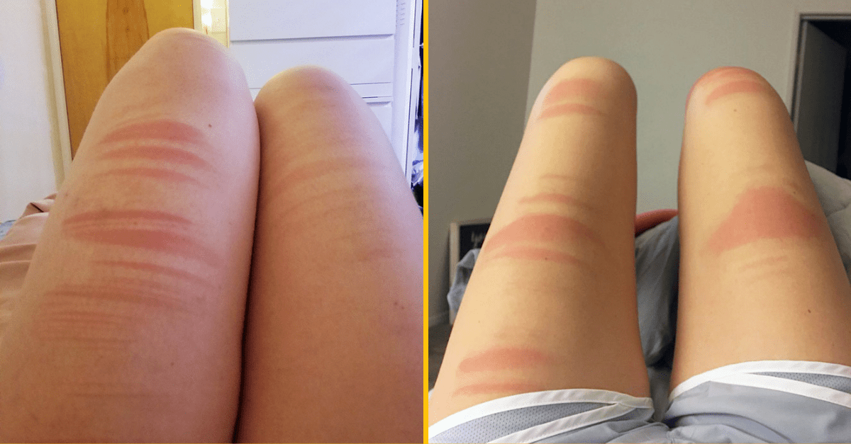 20+ ľudí, ktorí vám ukážu prečo v lete nenosiť rozrhané džíny