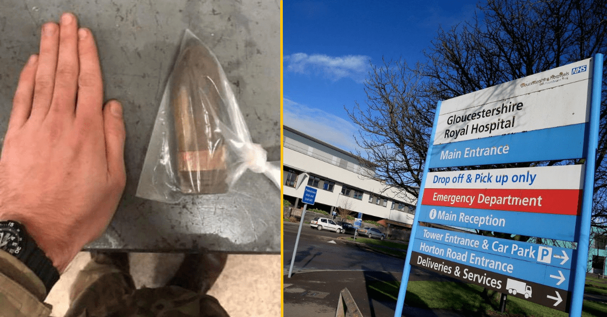 Do nemocnice v Anglicku museli byť povolaní pyrotechnici. Mužovi sa v zasekol delostrelecký granát na veľmi bizarnom mieste