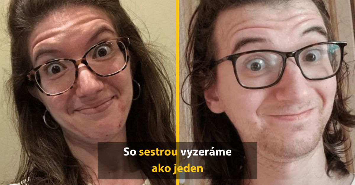 Gény sa nezaprú a potvrdzuje to aj týchto 10 ľudí