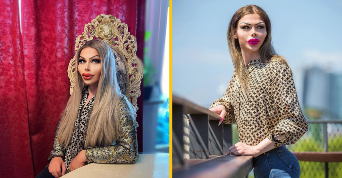 Patrick minuli na plastické operácie už viac ako 70 000. Prestať však nehodlajú