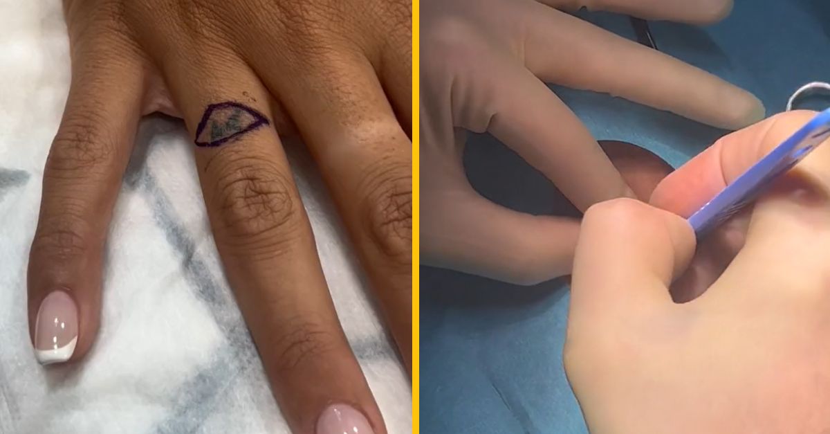 Namiesto toho, aby si dala odstrániť tetovanie, nechala si ho rovno odrezať. Tvrdí, že je to rýchlejšie