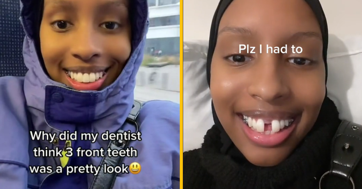 Žena má tri prvé rezáky. Zubár jej dal zub navyše, pretože to podľa neho bolo estetické