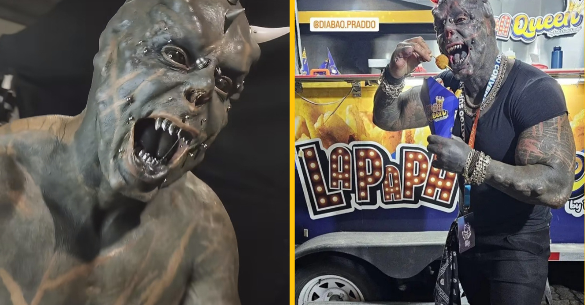 Muž si dal dobrovoľne odstrániť pár prstov, aby jeho ruky vyzerali ako drápy