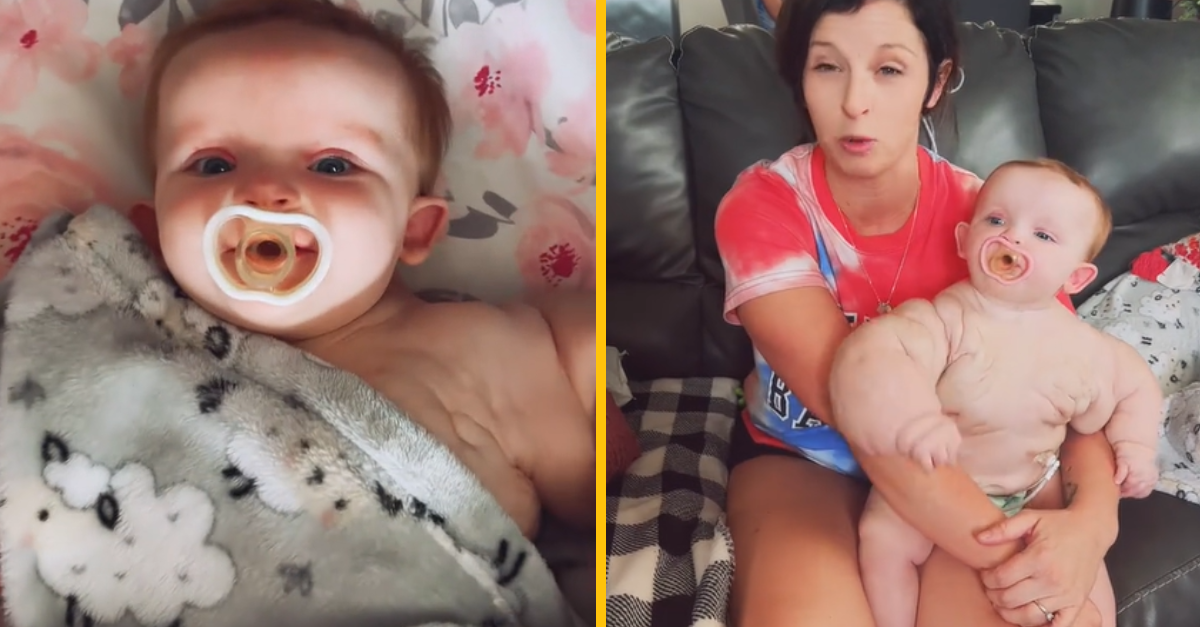 Nazývajú ju „Baby Hulkom“ pre jej neobvyklý vzhľad. Dievčatko pritom bojuje s vážnym ochorením