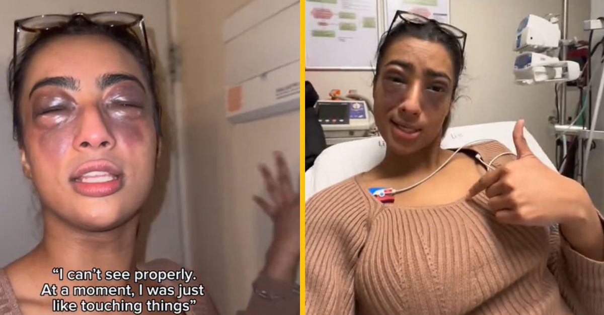 Namiesto toho, aby použila EpiPen, influencerka natočila video. Silná alergia ju takmer zabila