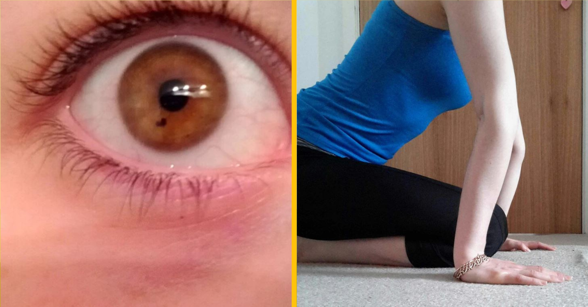 15 ľudí, ktorých vzácne vlastnosti ich robia jedinečnými