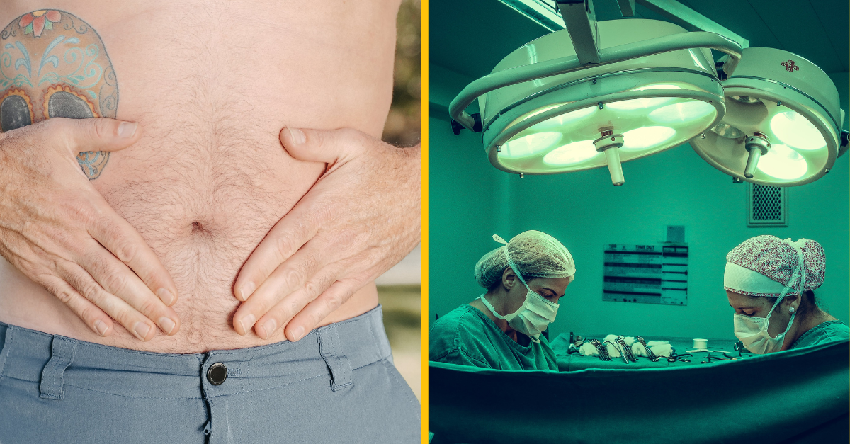 Namiesto slepého čreva mu lekári nechtiac vyoperovali kus úplne iného orgánu