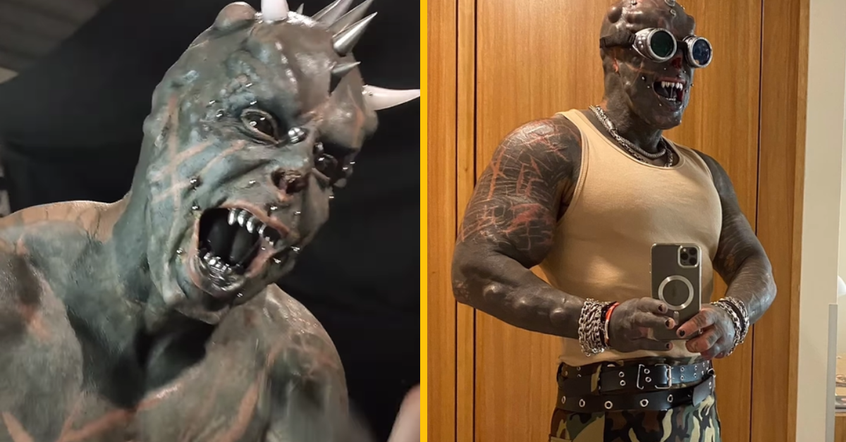 Muž nazývaný „Ľudský Satan“ sa nechal znova upraviť. Nechal si amputovať prsty, aby jeho ruky vyzerali ako pazúry