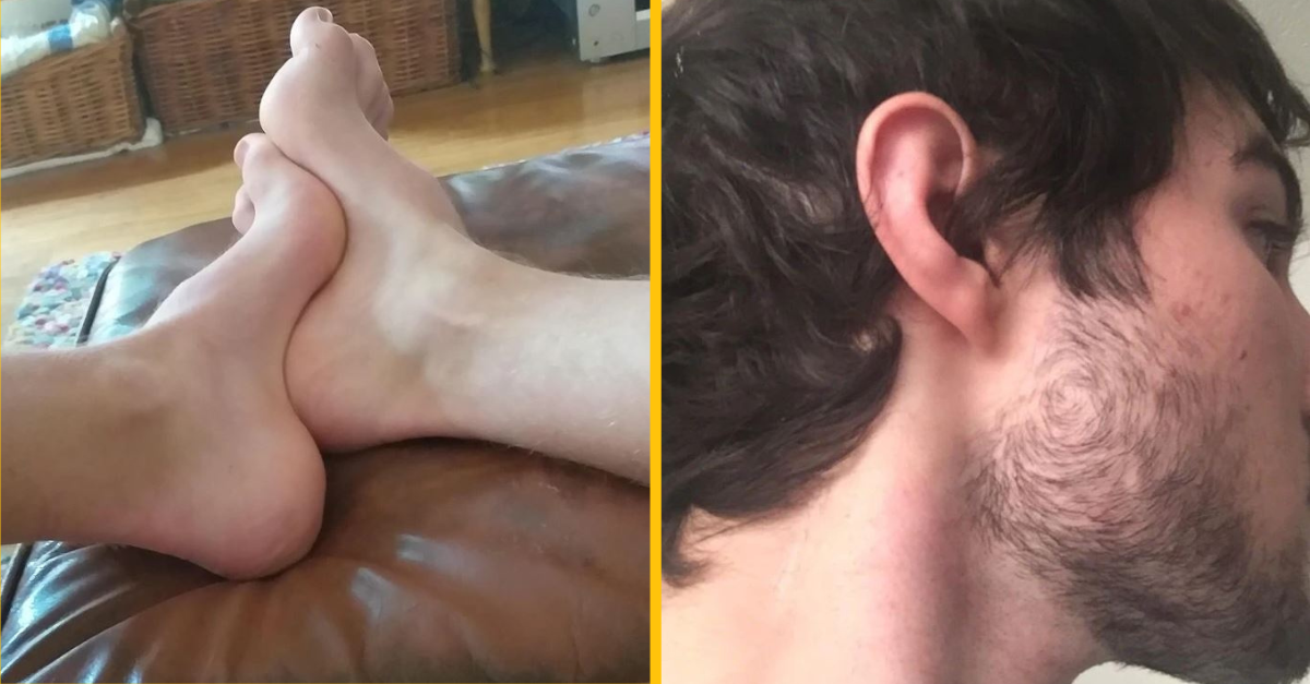 15 ľudí, ktorí sa narodili so špeciálnymi telesnými vlastnosťami, vďaka ktorým sú jedineční svojho druhu