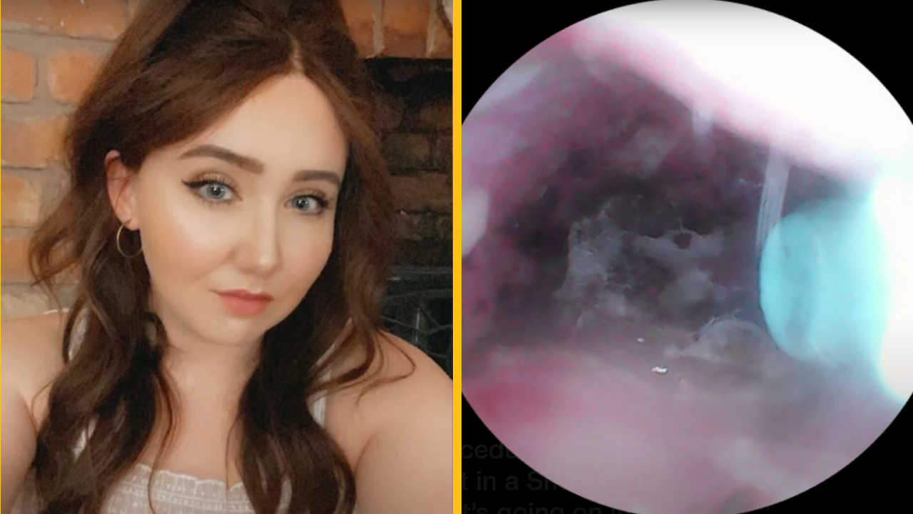 Mamička troch detí sa zobudila do nočnej mory – pavúk jej nakládol mladé pavúčiky do ucha