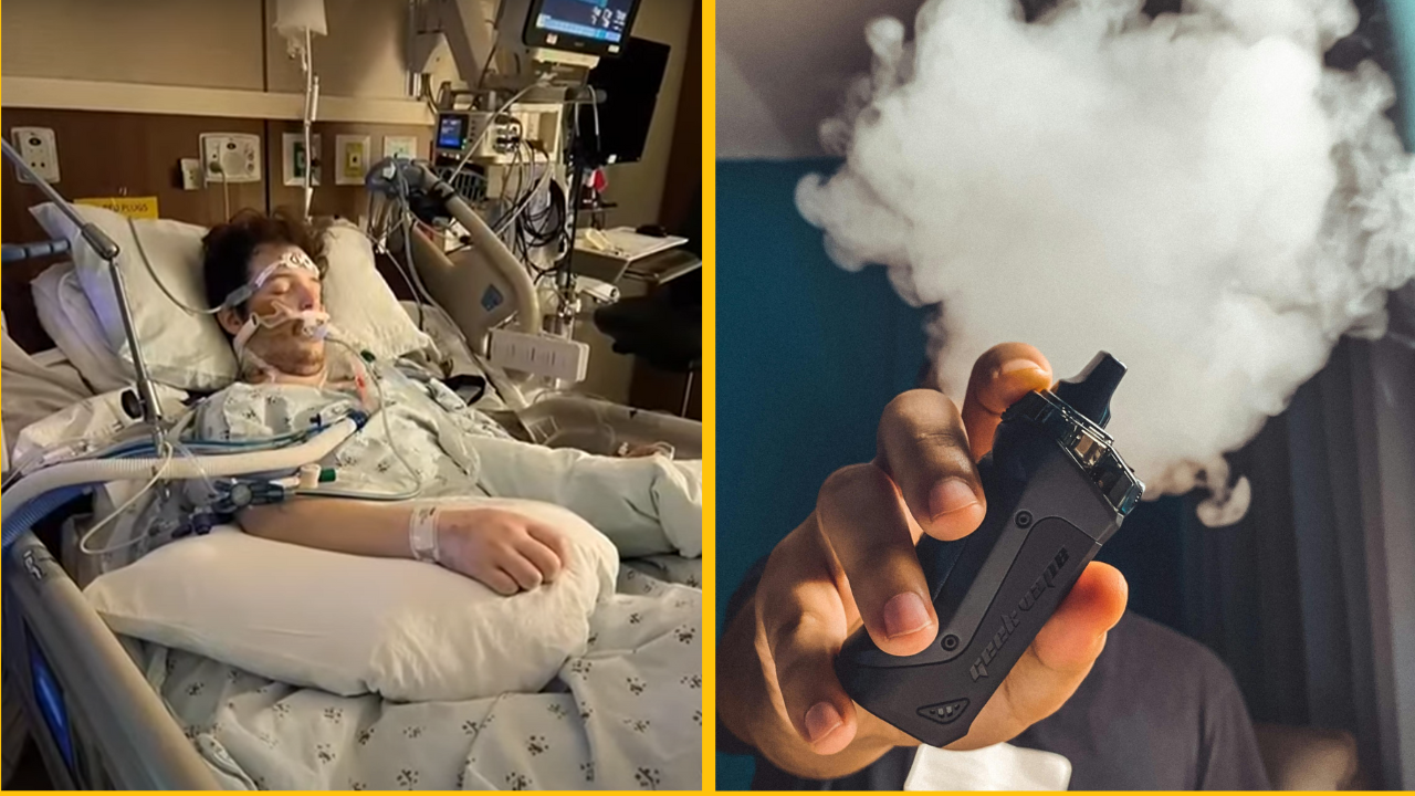 22-ročnému mladíkovi museli transplantovať obe pľúca kvôli závislosti na vape fajčení