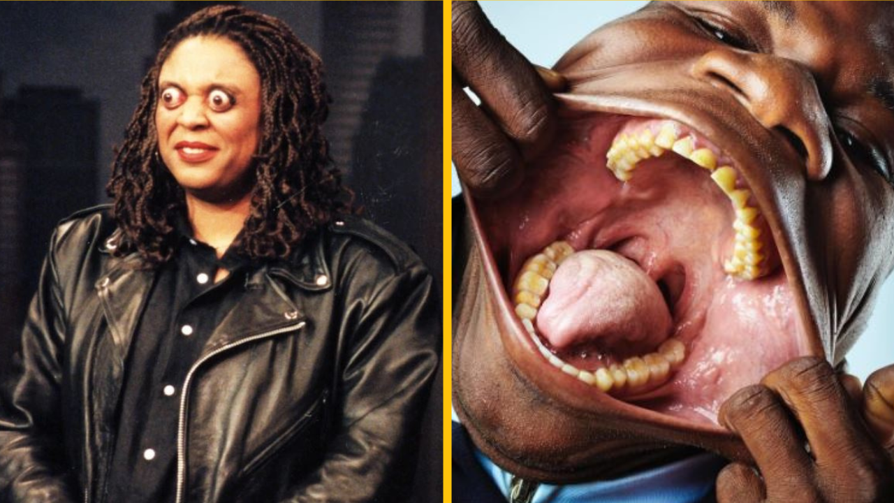 10 ľudí s mimoriadnymi fyzickými vlastnosťami, o ktorých neuveríte, že skutočne existujú