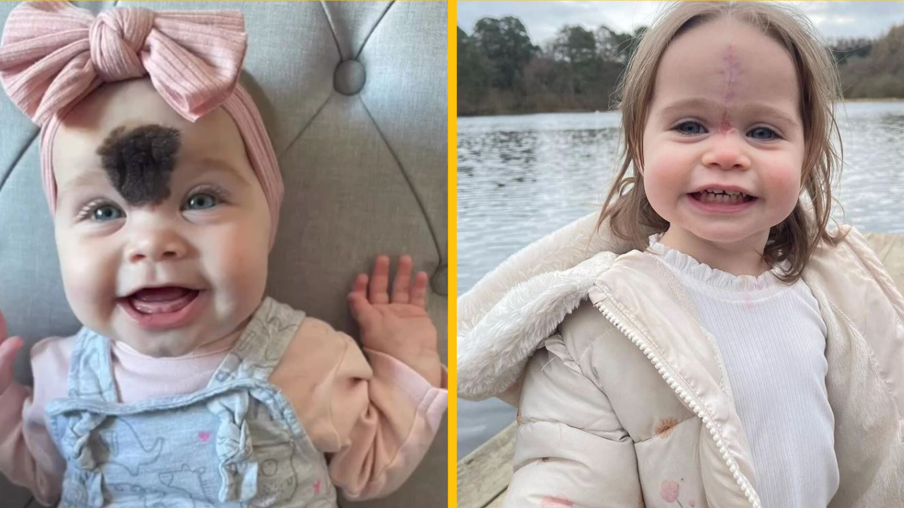 Rodičia poslali dcéru na operáciu kvôli strachu z posmechu