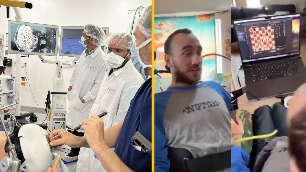 Prvý človek s čipom Neuralink od Elona Muska voperovaným do mozgu dokáže ovládať počítač mysľou
