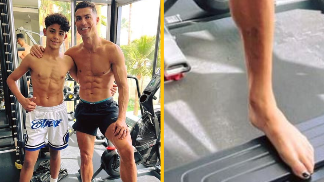 Ľudia si uvedomujú dôležitý dôvod, prečo Cristiano Ronaldo vždy nosí lak na nohách