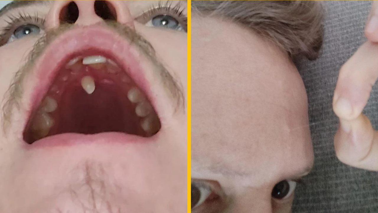 15 nezvyčajných telesných čŕt, na ktoré sme dnes neboli pripravení