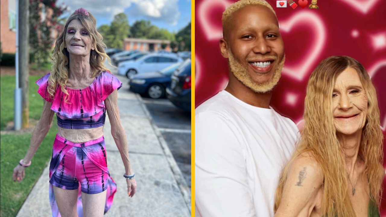 62-ročná žena si musí pri jedle vyberať zuby, no jej 25-ročnému mužovi to vôbec nevadí