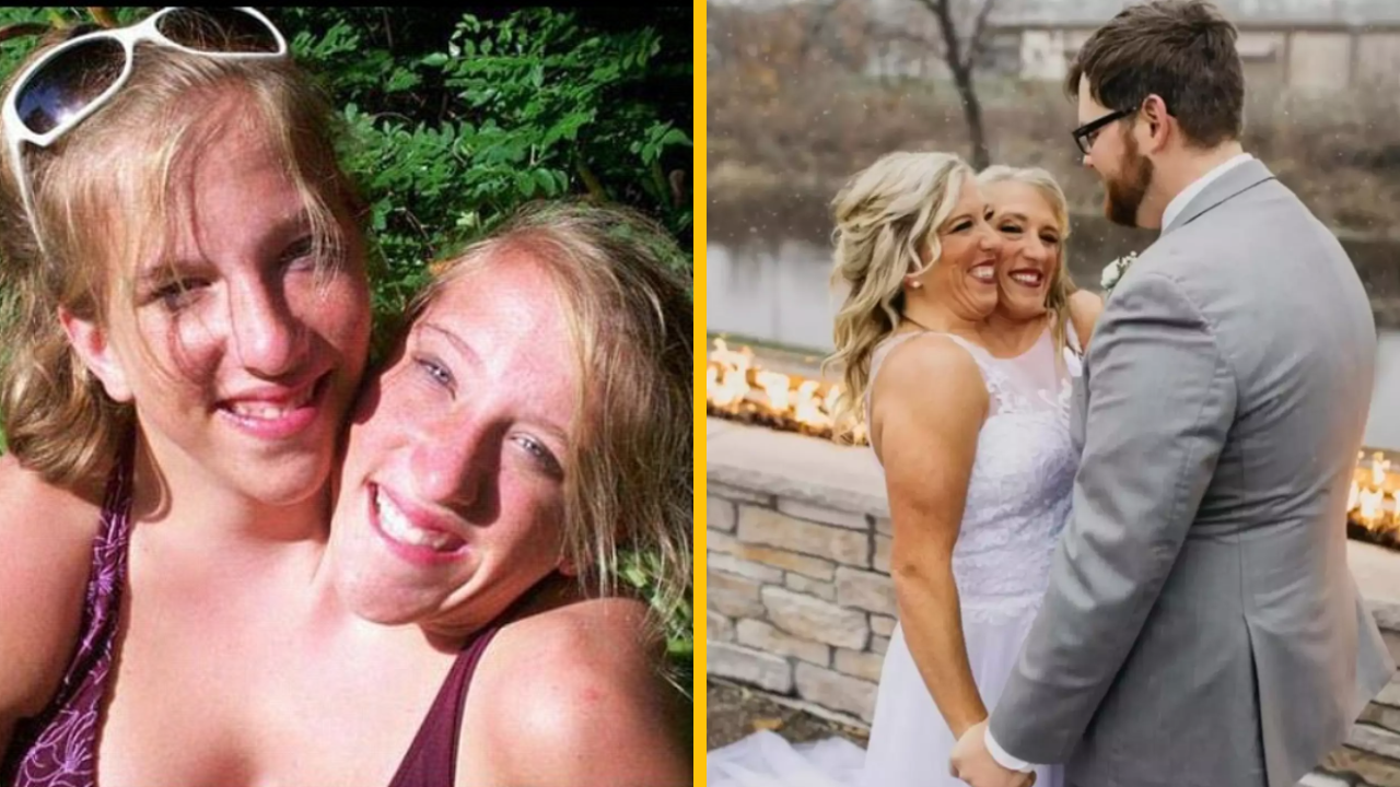 Muž má dve ženy v jednom tele – oženil sa so siamskými dvojčatami Abby a Brittany