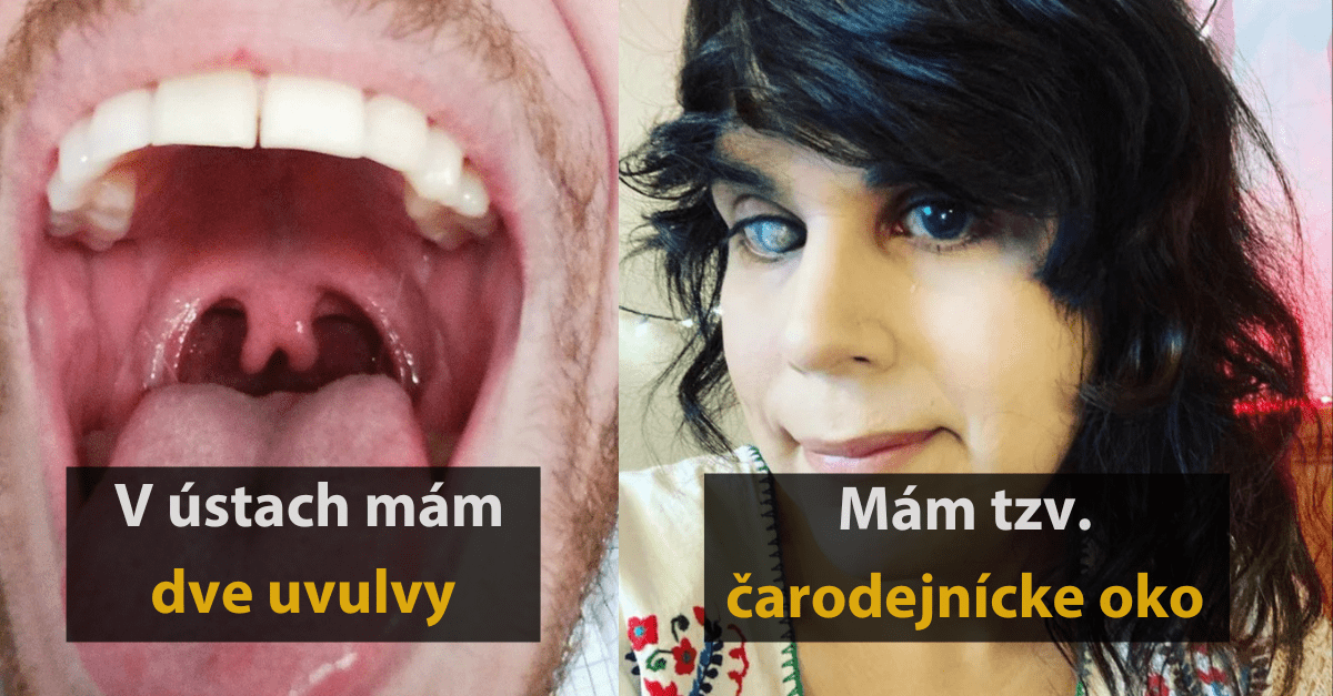 19 ľudí a zvierat, ktorým príroda darovala niečo extra