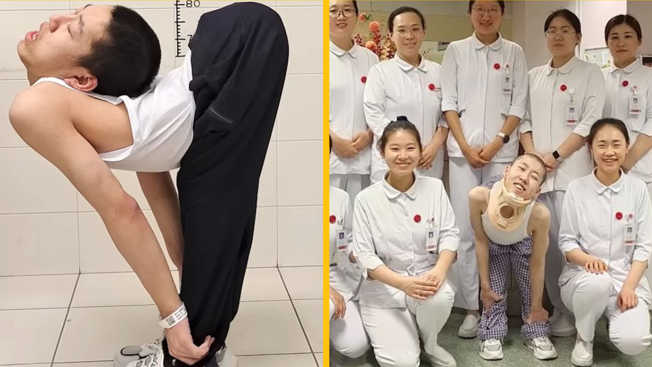 Tínedžer nazývaný „zložený chlapec“ je o krok bližšie k tomu, aby sa po riskantnom chirurgickom zákroku opäť postavil rovno