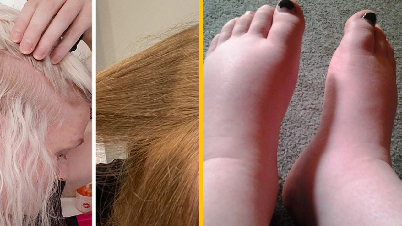 10 žien zdieľalo svoje necenzurované skúsenosti s tehotenstvom