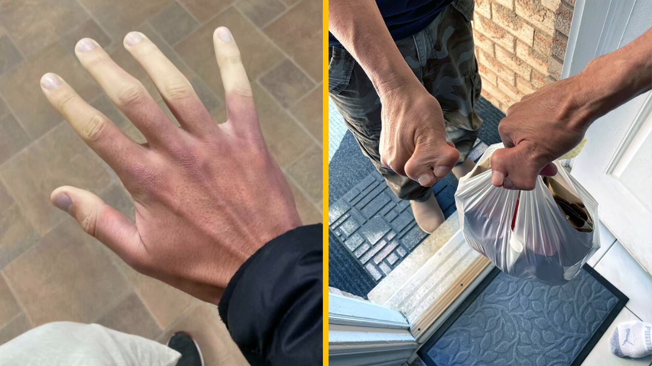 Genetika týchto ľudí z nich spravila naozaj výnimočné osoby