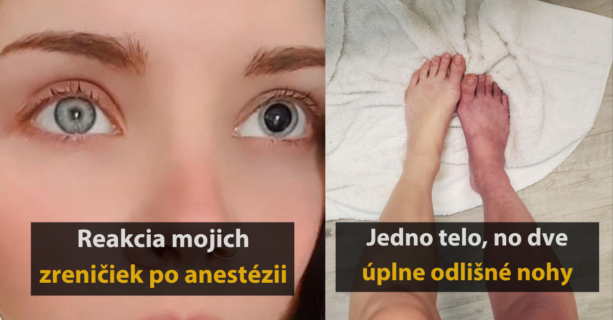 13 zaujímavých prekvapení, ktoré si pre nás pripravilo ľudske telo