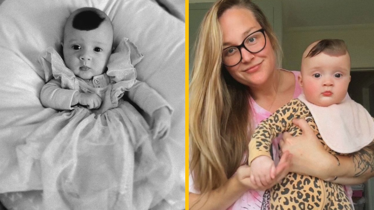 „Moja dcéra sa narodila s jednorožcovým materským znamienkom – odmietam jej ho dať odstrániť“