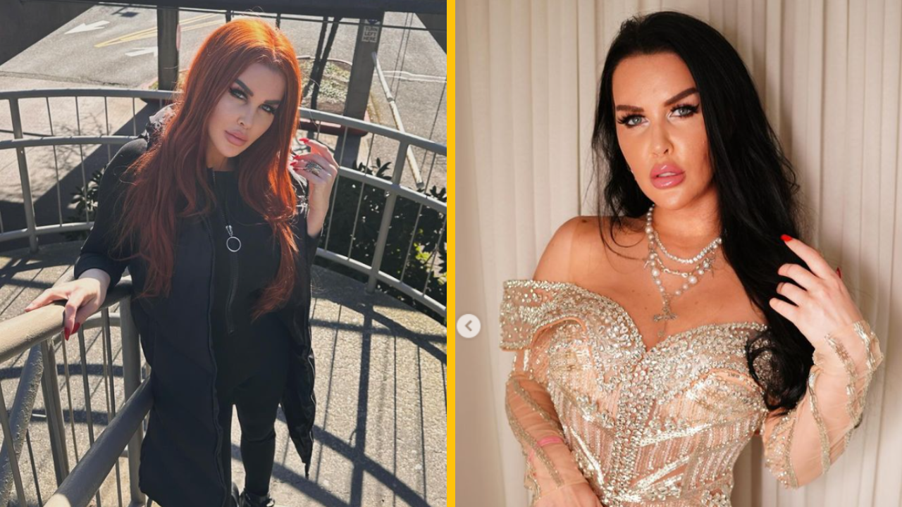 „Chcela som mať pár ako Kim Kardashian, tak som si dala odstrániť 2 rebrá“