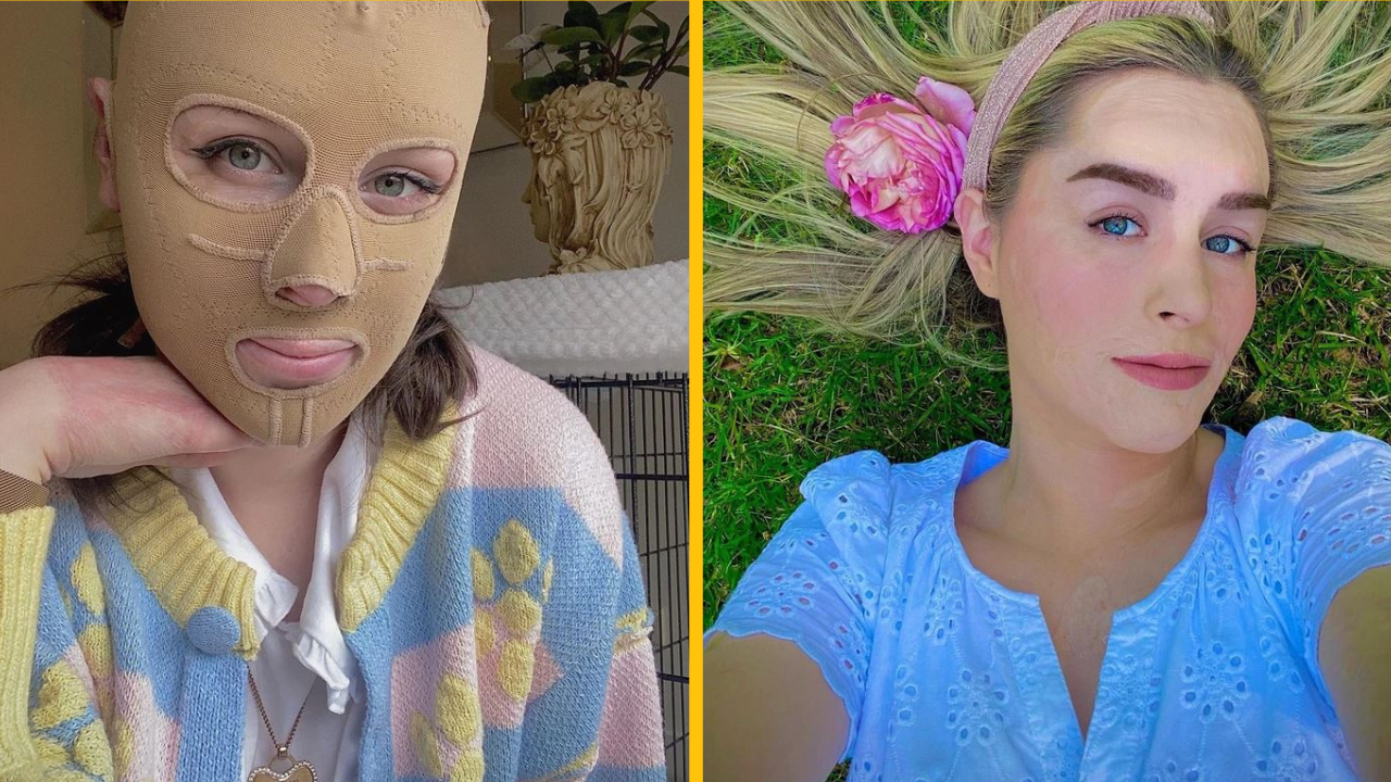 Ako dnes žije dievča, ktoré zázračne prežilo erupciu sopky?