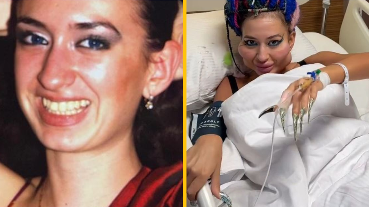 Pozrite sa, ako kedysi vyzerala žena, ktorá má teraz najväčšie líca na svete