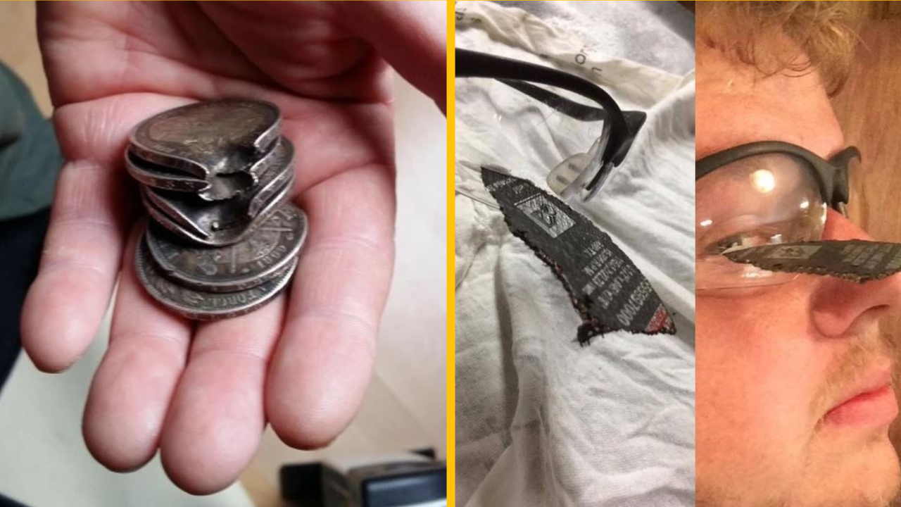 15+ ľudí, ktorí podviedli smrť a prežili, aby prerozprávali svoj príbeh