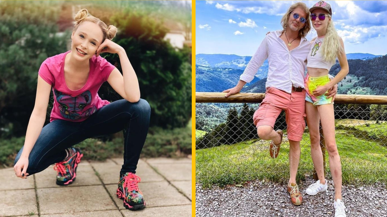 Žena minula 130 000 libier na operáciu predĺženia nôh kvôli poznámkam svojho manžela