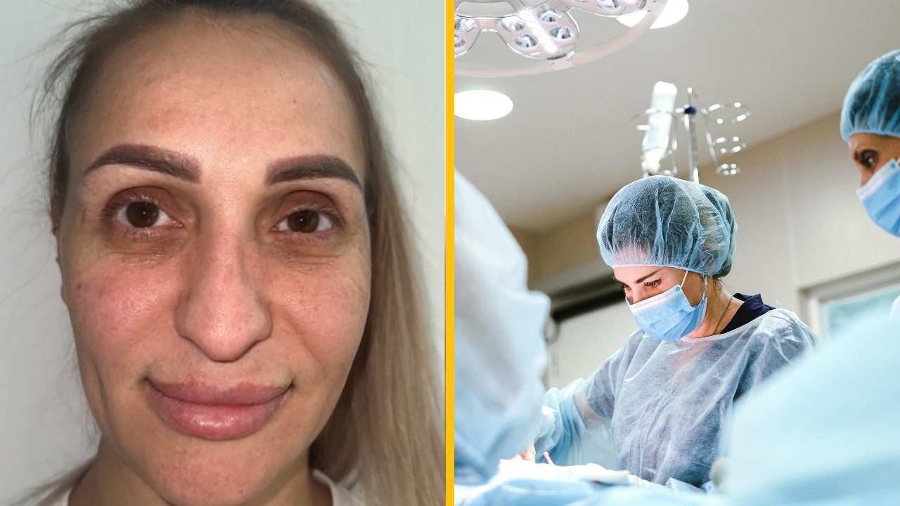 Plastická operácia žena dopadla tak, že ľudia hovoria, že potrebuje nový pas